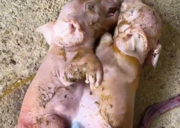 Bizarre: Conjoined twins